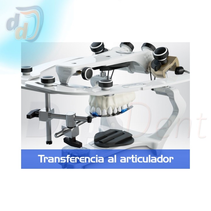 Transferencia del registro al articulador con el arco facial Standard