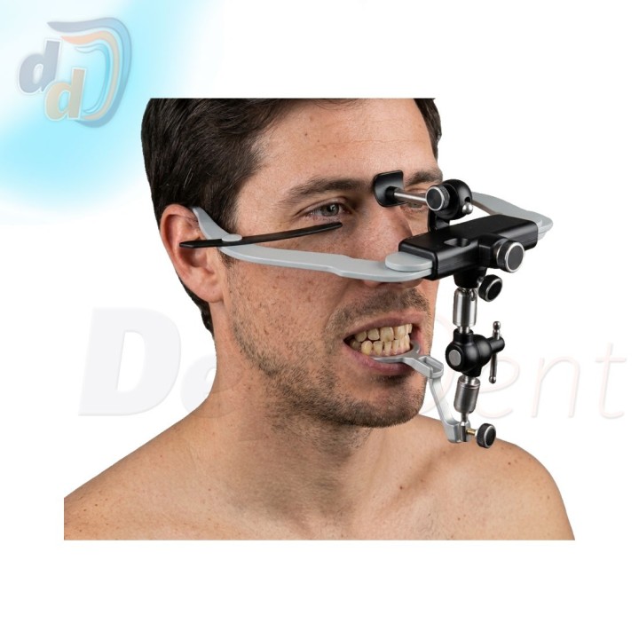 Arco facial Élite de Bio-Art colocado en un paciente