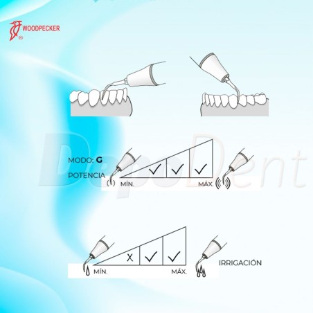 Esquema puntas ultrasonidos Woodpecker GD4T