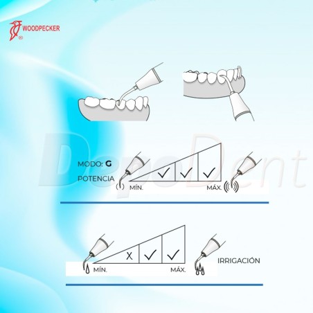 Esquema puntas ultrasonidos Woodpecker GD6