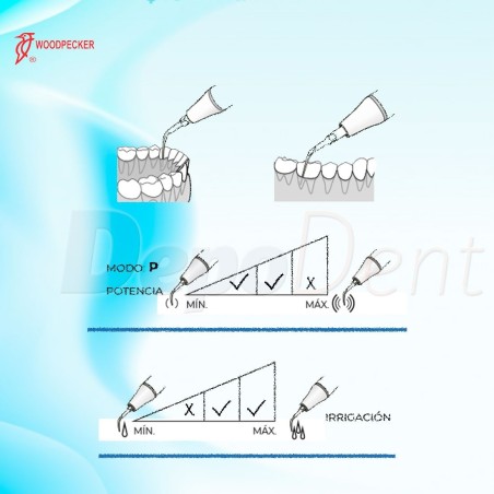 Esquema puntas ultrasonidos Woodpecker PD3D