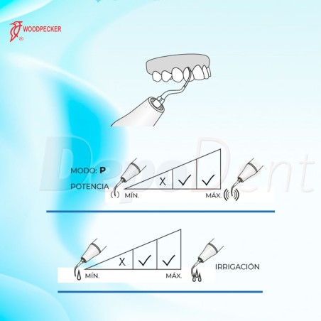 Esquema puntas ultrasonidos Woodpecker PD12