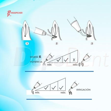 Punta ultrasonidos compatible SATELEC ED20D