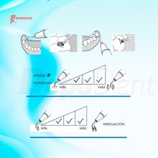 Punta ultrasonidos compatible EMS SB1