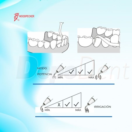 Punta ultrasonidos para profilaxis A1 compatible LM