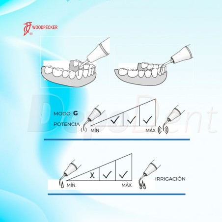 Punta ultrasonidos GC1 Perio compatibles KaVo Piezolux