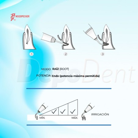 Puntas Cirugía UE2 para endodoncia compatibles con Mectron
