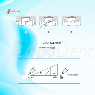 Puntas Cirugía UP1 Woodpecker para Perio compatibles con Mectron