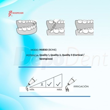 Puntas Cirugía US1 para Osteotomía compatibles con Mectron