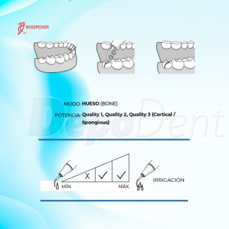 Puntas Cirugía US1 para Osteotomía compatibles con Mectron