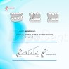 Puntas Cirugía US1 para Osteotomía compatibles con Mectron