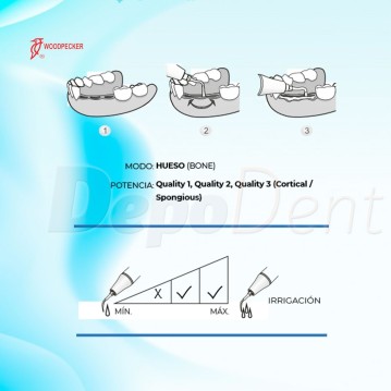 Puntas Cirugía US2 para Osteotomía compatibles con Mectron