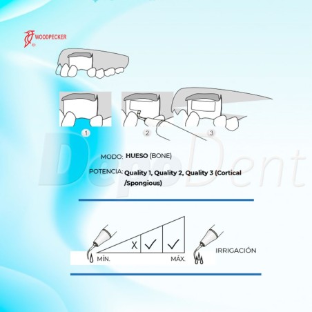 Puntas Cirugía US3 para Osteotomía compatibles con Mectron