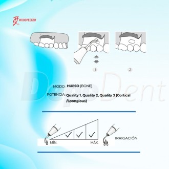 Puntas Cirugía US4 para Osteoplastia compatibles con Mectron