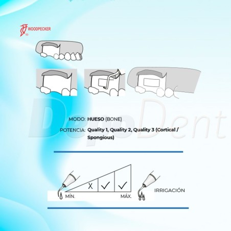 Puntas Cirugía US1R para Osteotomía compatibles con Mectron