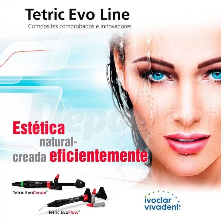 Tetric EvoCeram cavifils composites