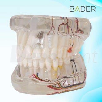 Modelo dental de implante con nervio