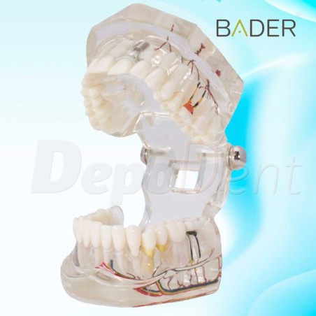 Modelo dental de implante con nervio Vista abierto