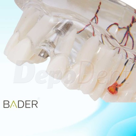 Modelo dental de implante con nervio detalle