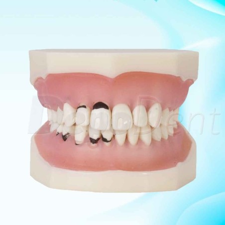 tipodonto periodoncia