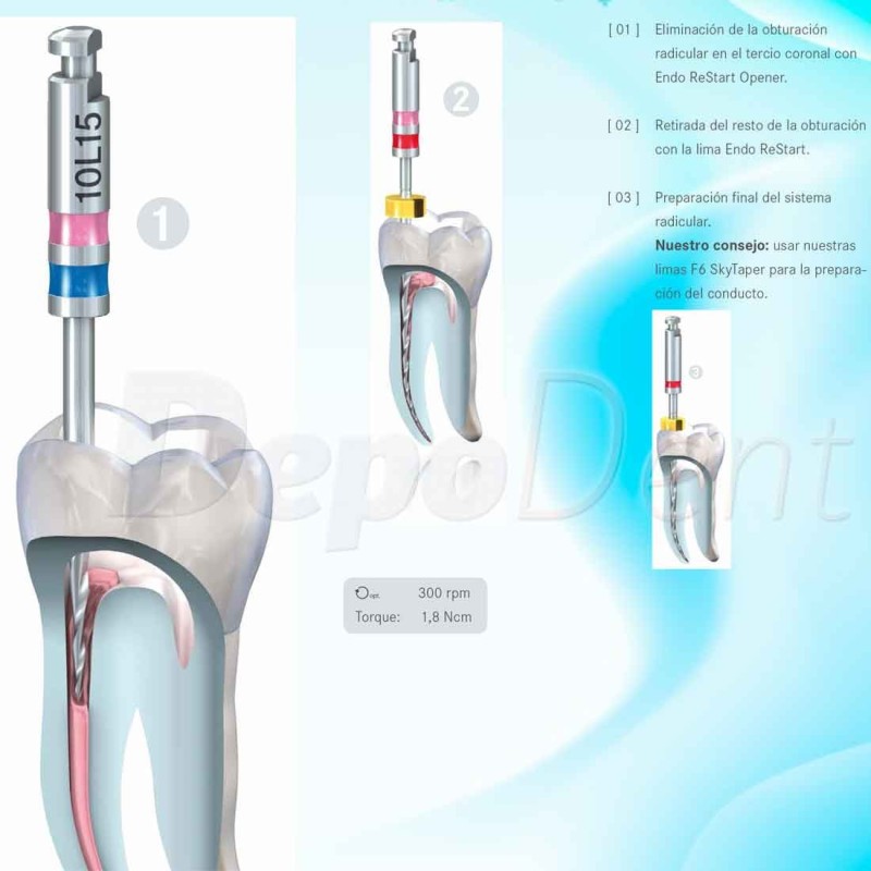 Limas endodoncia Komet EndoRestart