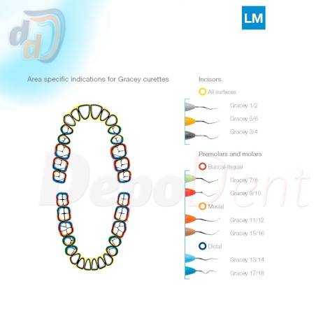Indicaciones área curetas Gracey